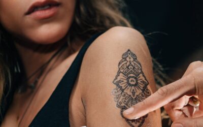 7 choses à savoir sur le détatouage laser d’un tatouage récent à Lyon