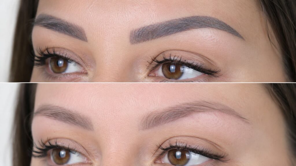 détatouage sourcils avant après